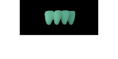 Cod.C24Facing : 15x  wax facings-bridges, SMALL, Overlapping, TOOTH 42-32, compatible with Cod.A24Lingual,TOOTH 42-32 for long-term provisionals preparation